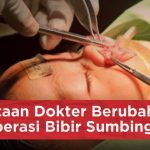 Operasi Rekonstruksi Sumbing Langkah Menuju Percaya Diri Loh
