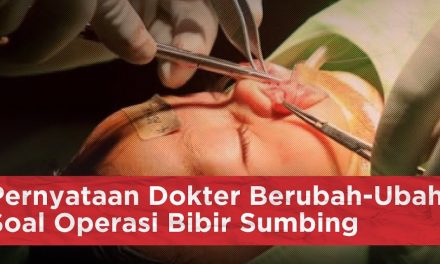 Operasi Rekonstruksi Sumbing Langkah Menuju Percaya Diri Loh