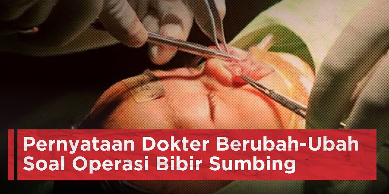 Operasi Rekonstruksi Sumbing Langkah Menuju Percaya Diri Loh